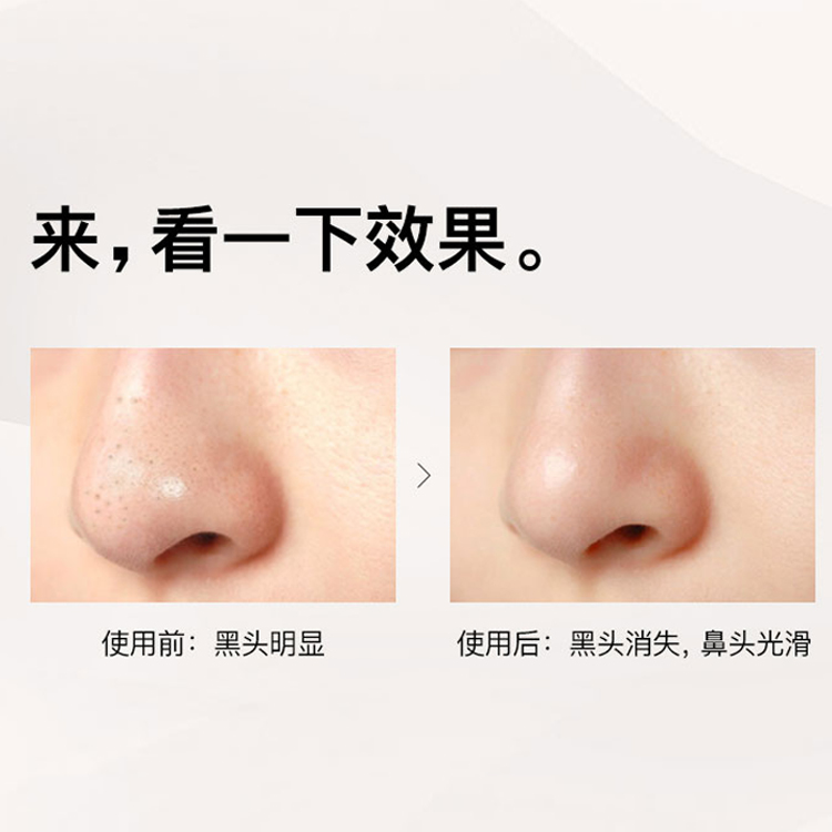 去黑頭鼻貼