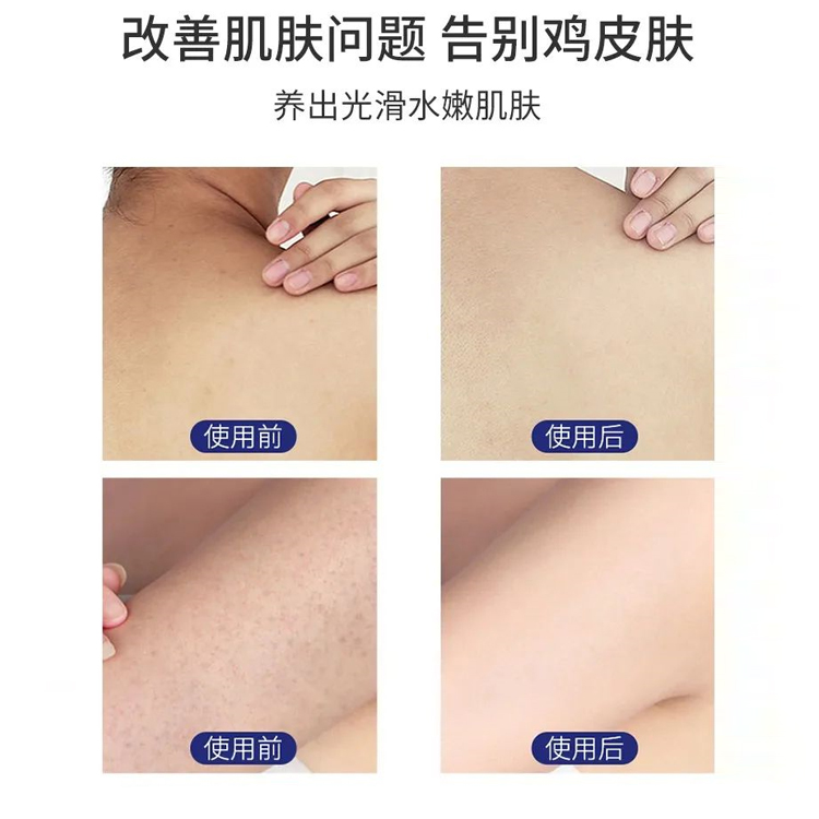 維E尿素霜加工