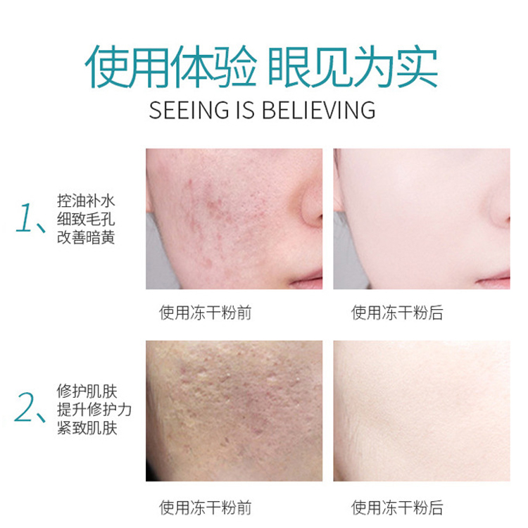 修護凍干粉